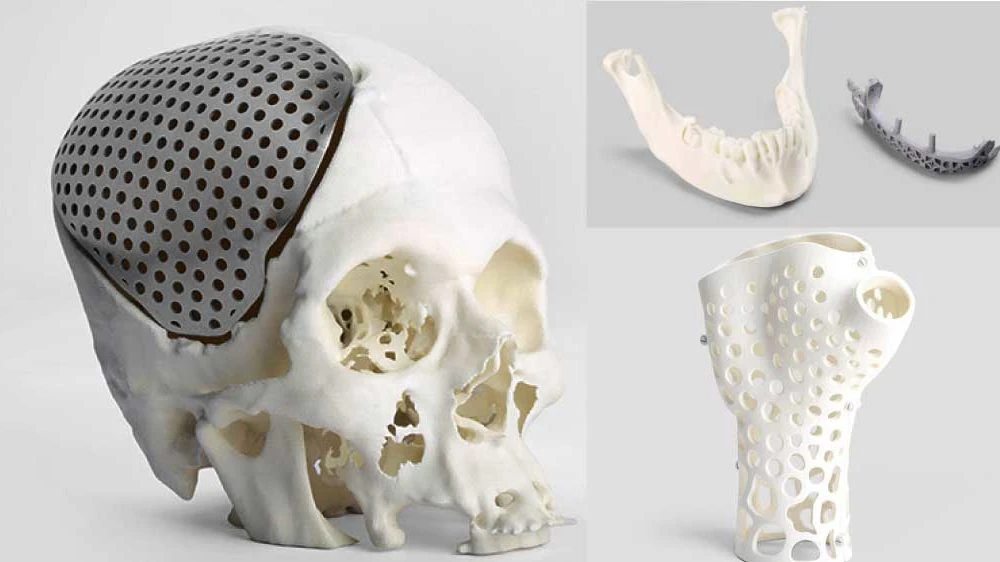 3d printed bones skull jaw