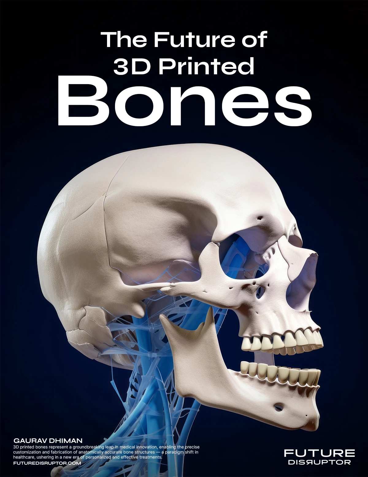 The Future of 3D Printed Bones