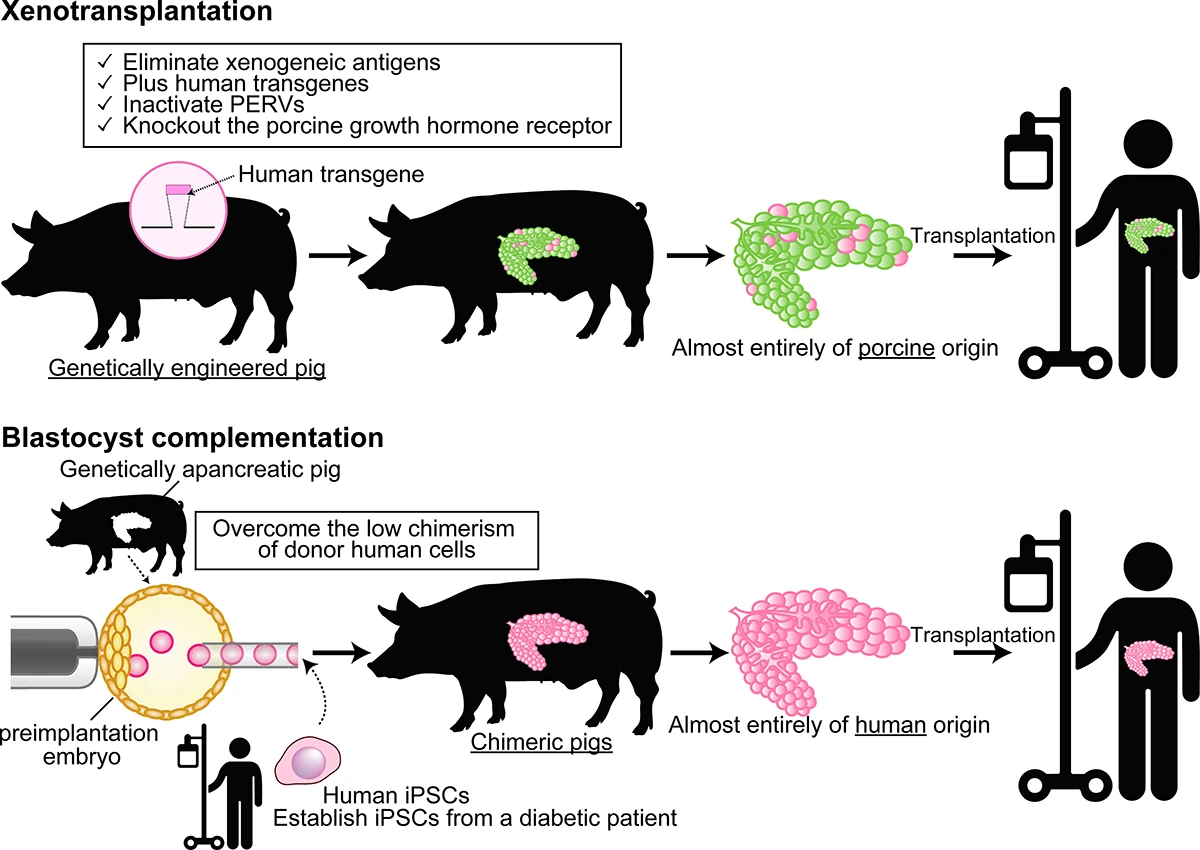 xenotransplantation process diagram